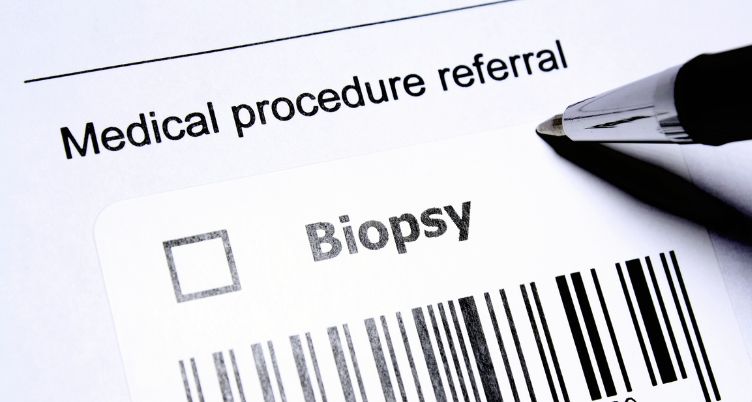 Testicular Biopsy