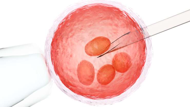 9 Things You Should Know Before Considering IVF