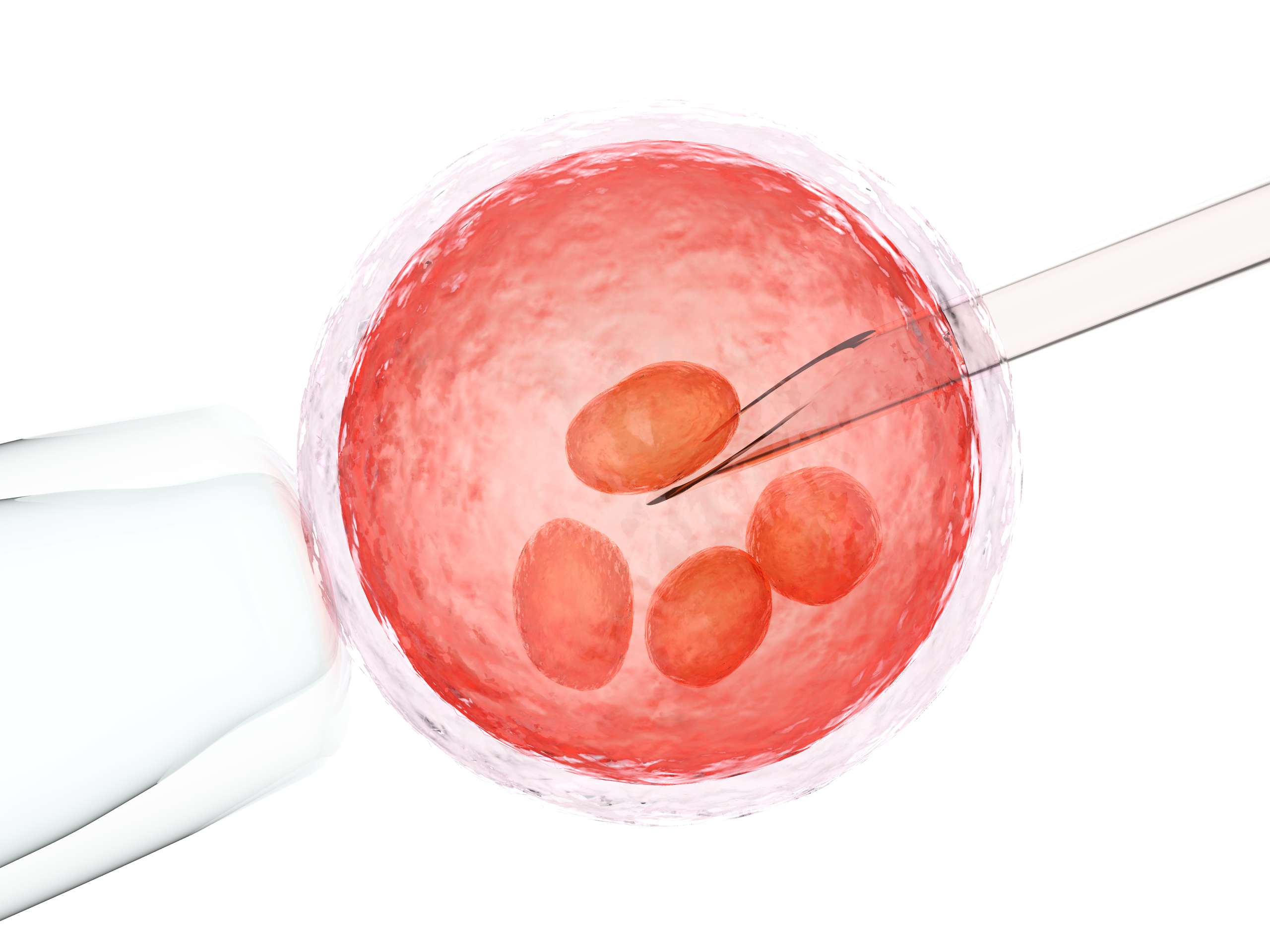 9 Things You Should Know Before Considering IVF